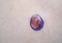 哪些異狀出現時應立即就醫？